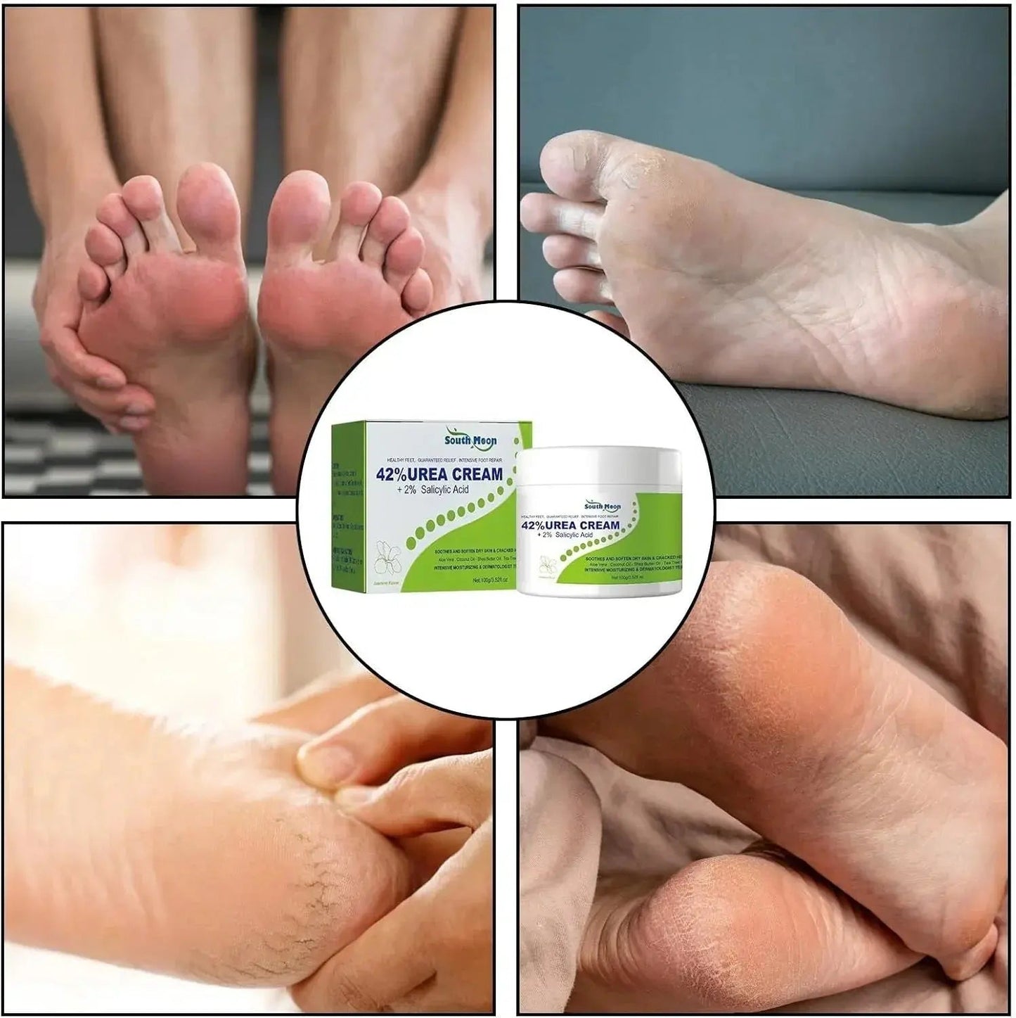 South Moon - 42% Urea Cream + 2% Salicylic Acid (Original) My Store