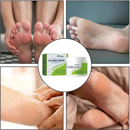 South Moon - 42% Urea Cream + 2% Salicylic Acid (Original) My Store